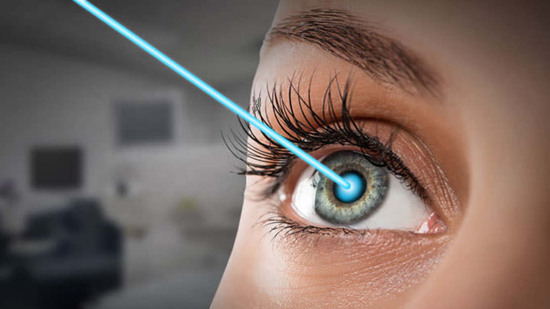 You are currently viewing Things to consider before going for laser eye surgery